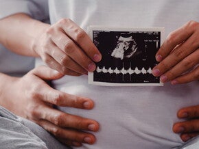 Foto de mãe segurando imagem de ultrassom Foto de mãe segurando imagem de ultrassom