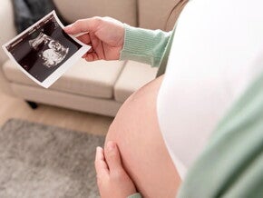 Gestante segurando a imagem de uma ultrassonografia