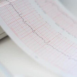 Cardiograma sendo impresso durante exame Cardiograma sendo impresso durante exame