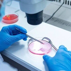 Imagem de laboratório onde um embriologista, usando luvas cirúrgicas, manipula material biológico em uma placa de Petri sob um microscópio, parte do processo de criopreservação de óvulos.