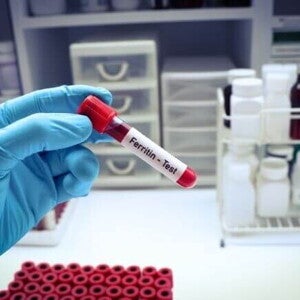 Tubo de ensaio para teste de ferritina, essencial para diagnosticar ferritina baixa na gestação e prevenir a anemia ferropriva.