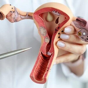 Imagem de um médico segurando um modelo realista do sistema reprodutor feminino Imagem de um médico segurando um modelo realista do sistema reprodutor feminino