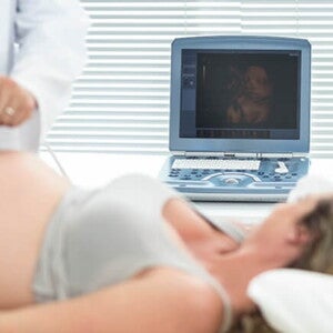 Imagem de uma gestante em um ambiente hospitalar fazendo exame de translucência nucal Imagem de uma gestante em um ambiente hospitalar fazendo exame de translucência nucal