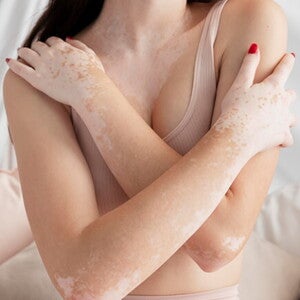 Mulher com top da cor da pele dela abraçando o corpo Mulher com top da cor da pele dela abraçando o corpo