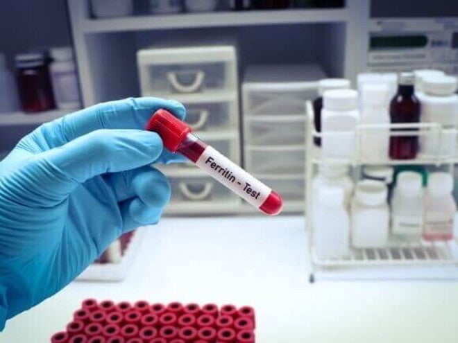 Tubo de ensaio para teste de ferritina, essencial para diagnosticar ferritina baixa na gestação e prevenir a anemia ferropriva.