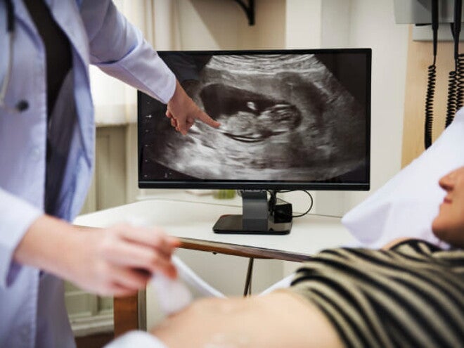 mulher grávida fazendo ultrassom, ao fundo uma tela exibindo a imagem do exame mulher grávida fazendo ultrassom, ao fundo uma tela exibindo a imagem do exame