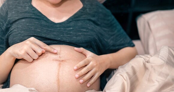 Gestante apontando com a linha nigra em sua barriga Gestante apontando com a linha nigra em sua barriga