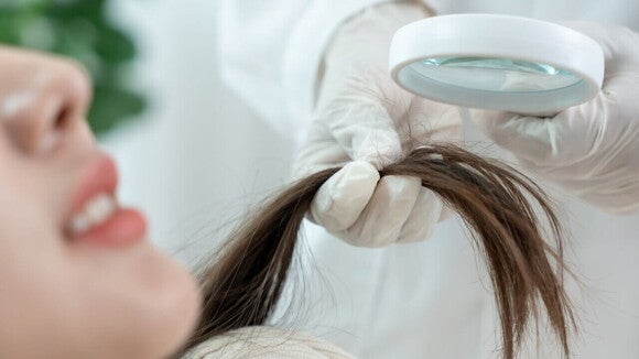 Uma médica, usando luvas brancas, examina a ponta do cabelo de uma paciente com uma lupa. A imagem ilustra a consulta médica sobre queda de cabelo pós-parto.