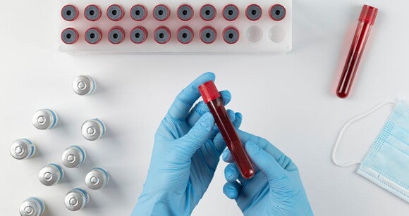 Uma imagem representando um moderno laboratório de análise de amostras de sangue Uma imagem representando um moderno laboratório de análise de amostras de sangue